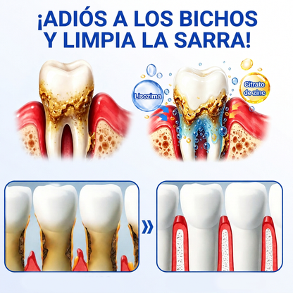 🇪🇸 VITALISYS®🦷 𝑮𝒖𝒎𝑹𝒆𝒗𝒊𝒗𝒆 Gel Regenerador Periodontal🍊