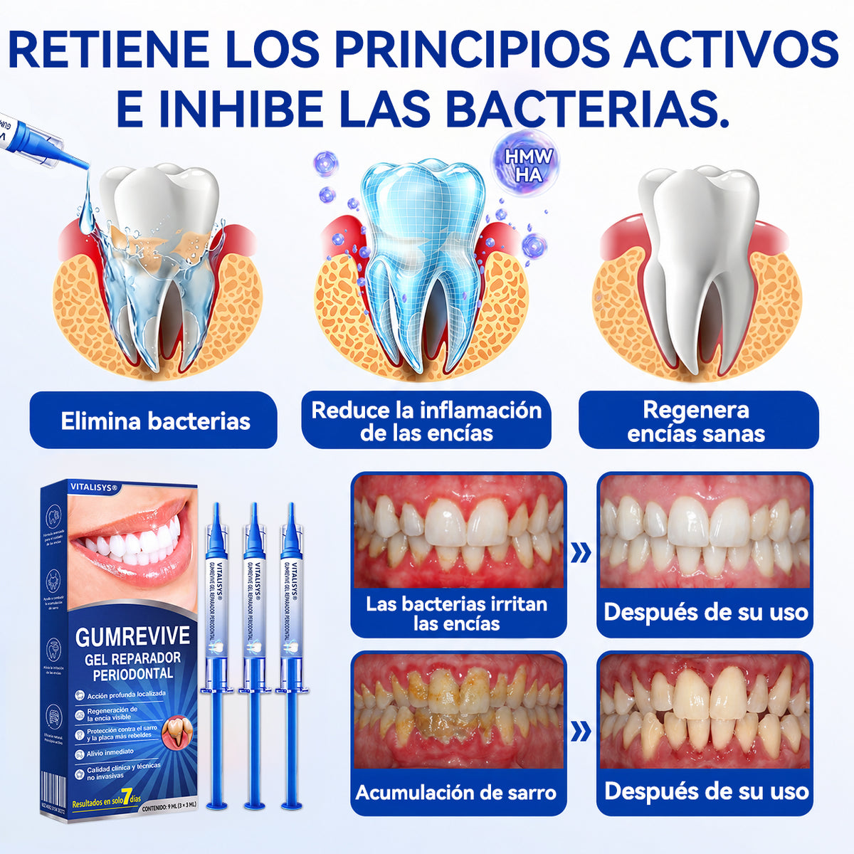🇪🇸 VITALISYS®🦷 𝑮𝒖𝒎𝑹𝒆𝒗𝒊𝒗𝒆 Gel Regenerador Periodontal🍊