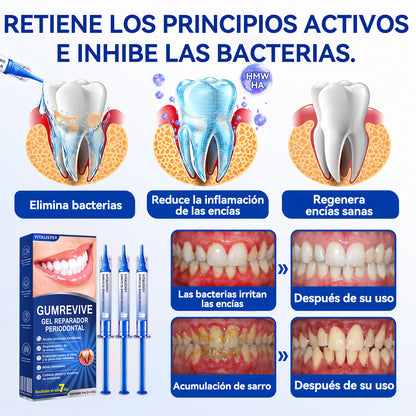 🇪🇸 VITALISYS®🦷 𝑮𝒖𝒎𝑹𝒆𝒗𝒊𝒗𝒆 Gel Regenerador Periodontal🍊